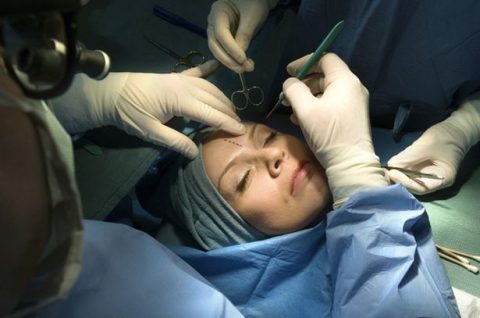 Plastic-Surgeons-operating-on-woman